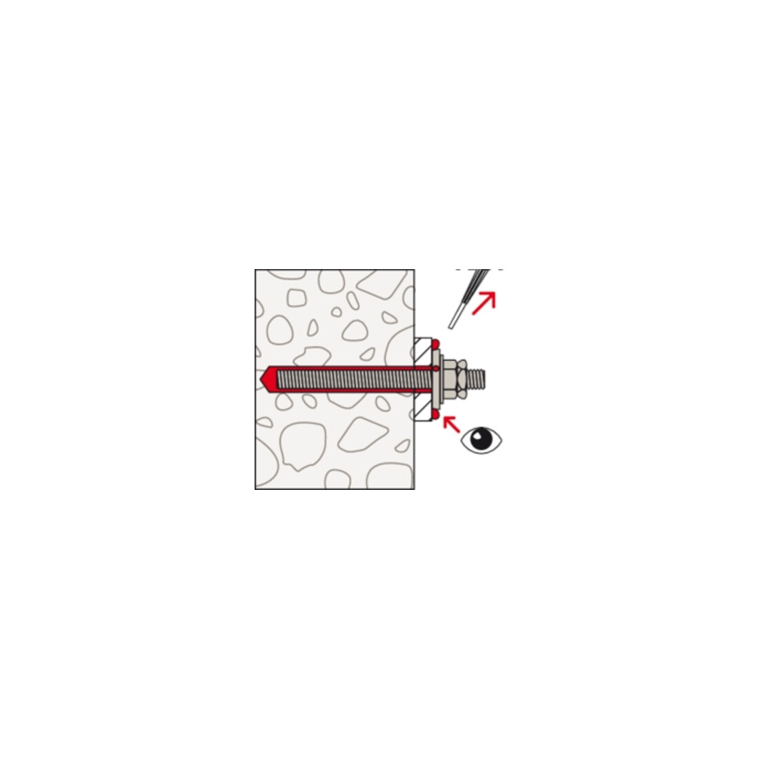 fischer Verfüllset M24 R – Bild 5